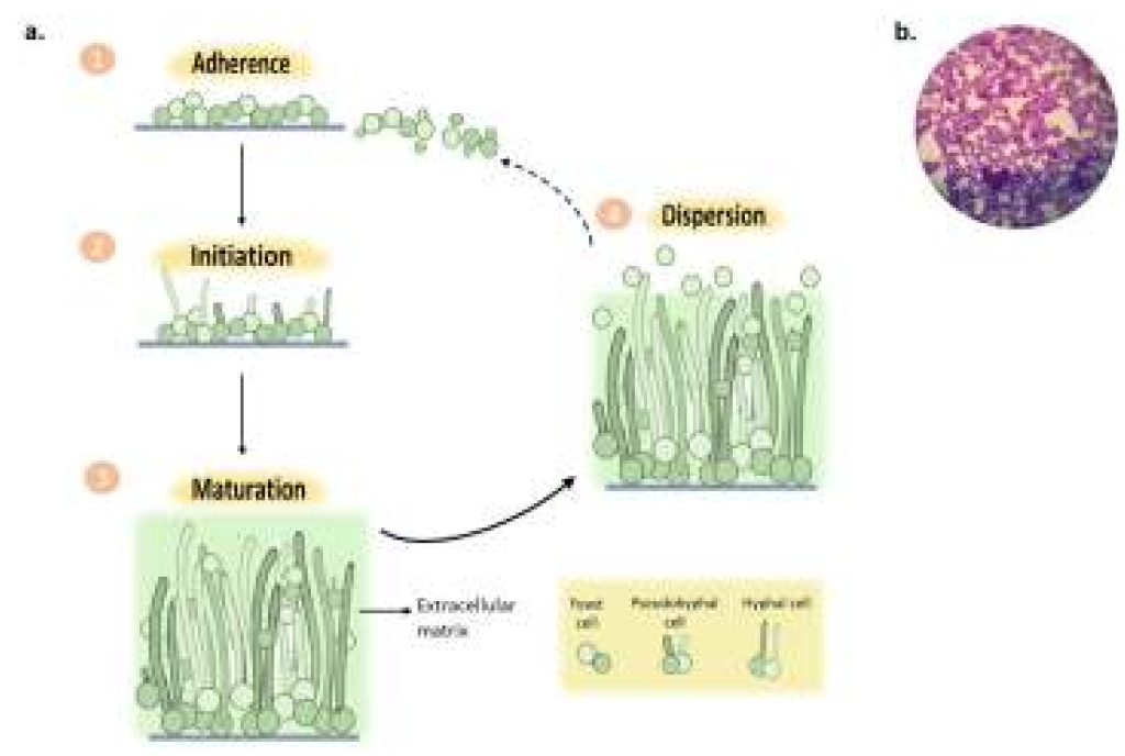 Red Betel Leaf: A Natural Solution Against Oral Infections Supporting Global Health Goals